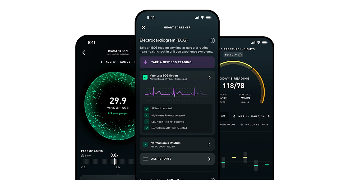 Фитнес-браслет Whoop MG Life чёрный (Подписка на 1 год) Фитнес-браслет Whoop MG Life чёрный (Подписка на 1 год) - 1